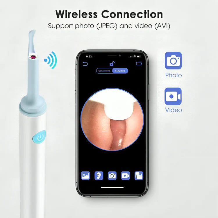 Ear Wax Removal Kits 