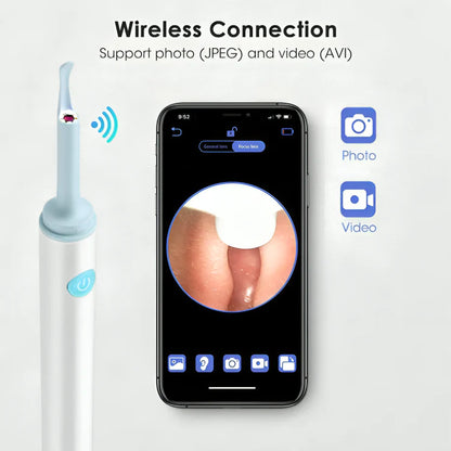 Ear Wax Removal Kits 