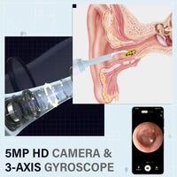 Ear Wax Removal Kits 